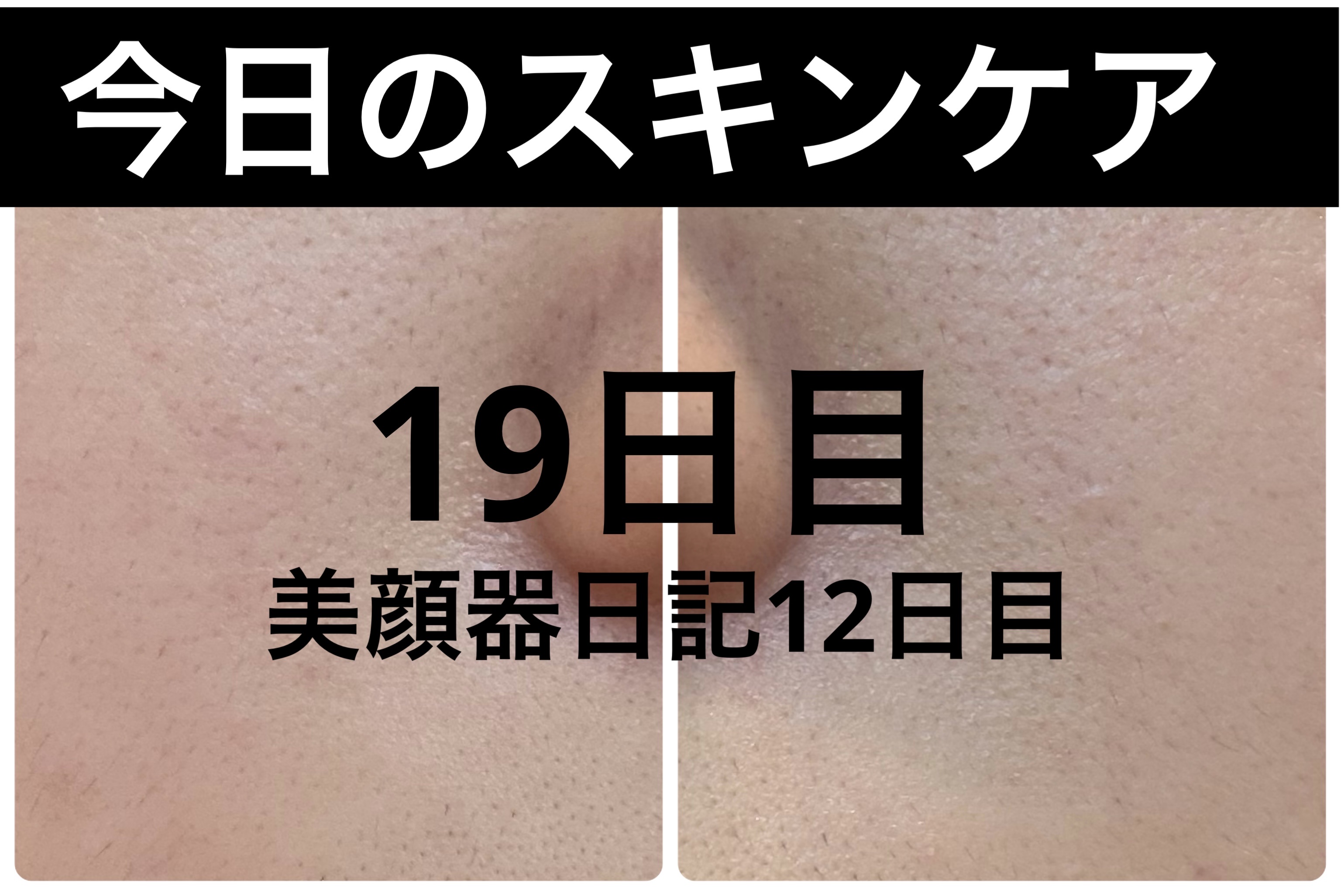 エターナルアイクリーム/リュバンブラン/アイケア・アイクリームを使ったクチコミ（1枚目）