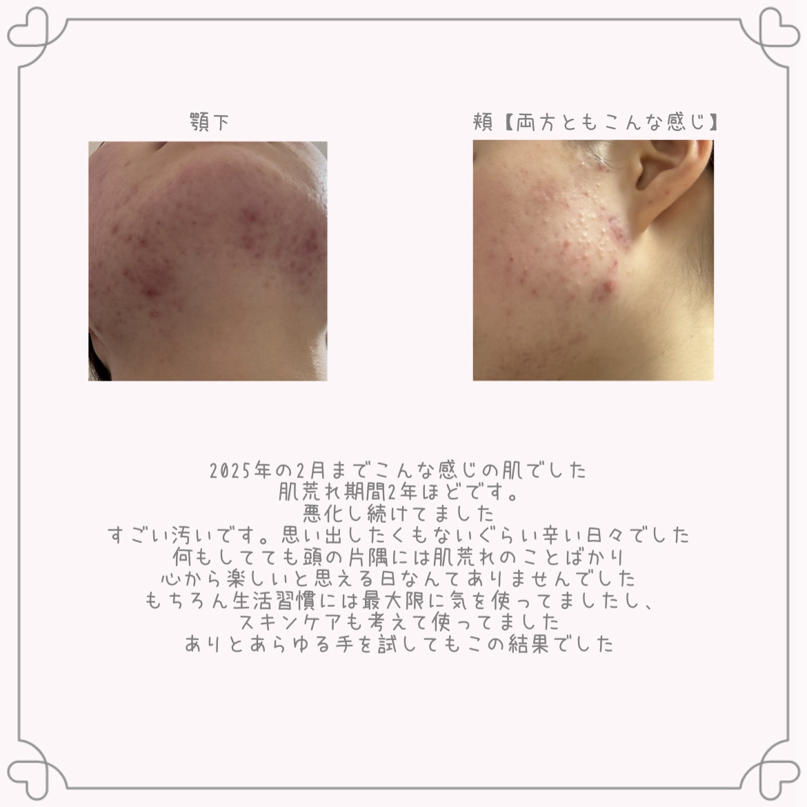 DS RTN リニューイング セラム/Kiehl's/美容液を使ったクチコミ（2枚目）