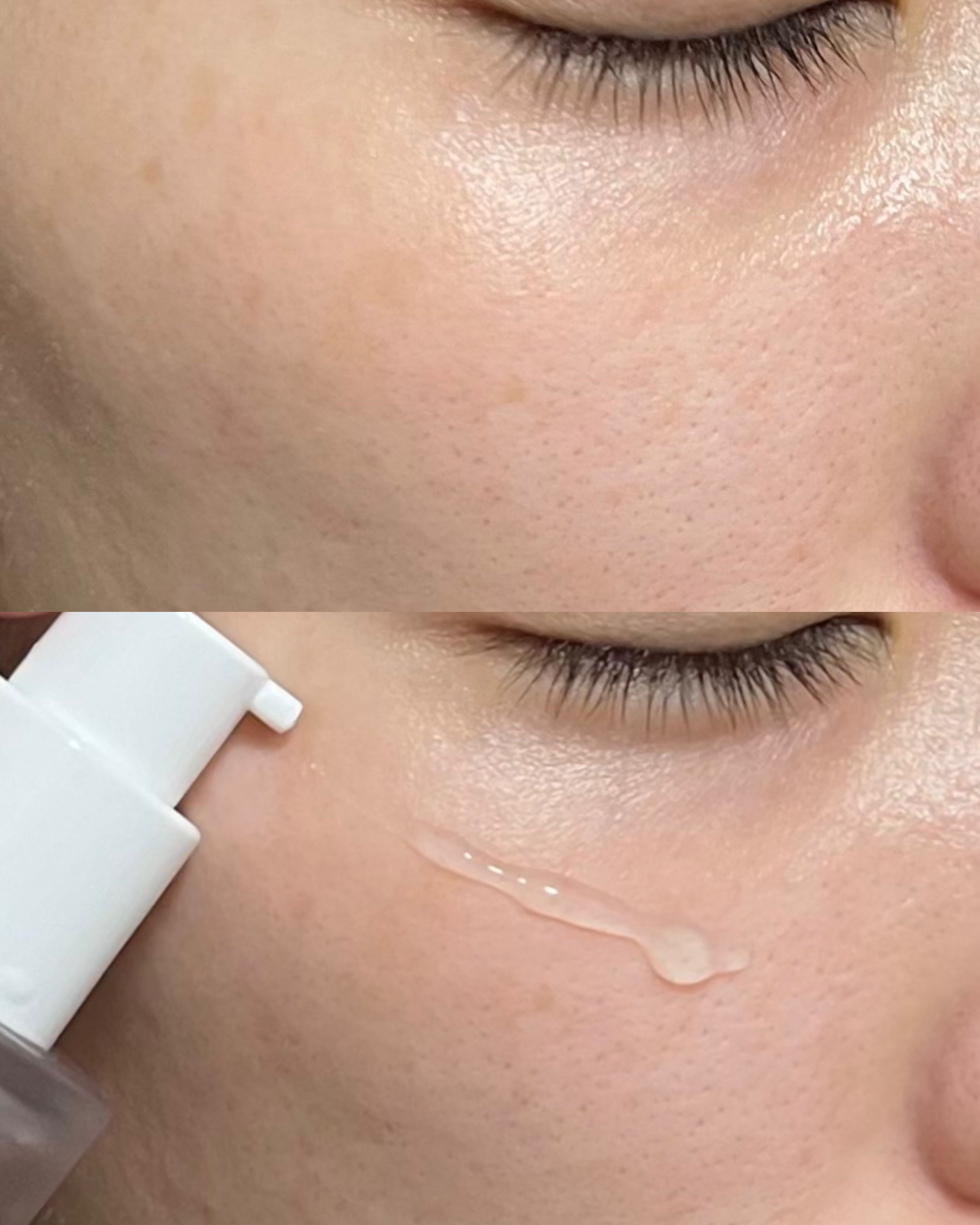 ダーマジェンシー ゼロカ81 セラム/DERMAGENCY/美容液を使ったクチコミ（3枚目）