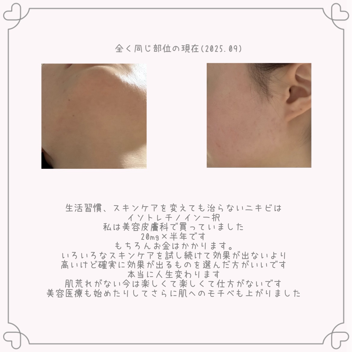 DS RTN リニューイング セラム/Kiehl's/美容液を使ったクチコミ（3枚目）