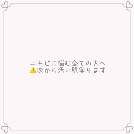 潤浸保湿 フェイスクリーム/キュレル/フェイスクリームを使ったクチコミ(1枚目)
