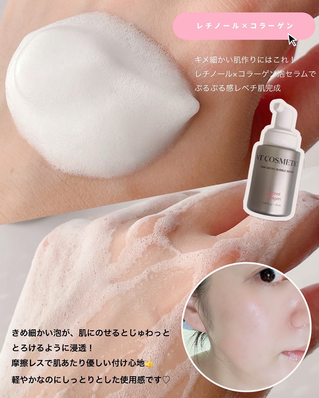 PDRN ヒアルロン酸 ミントマイクロバブルセラム/VT/美容液を使ったクチコミ（3枚目）