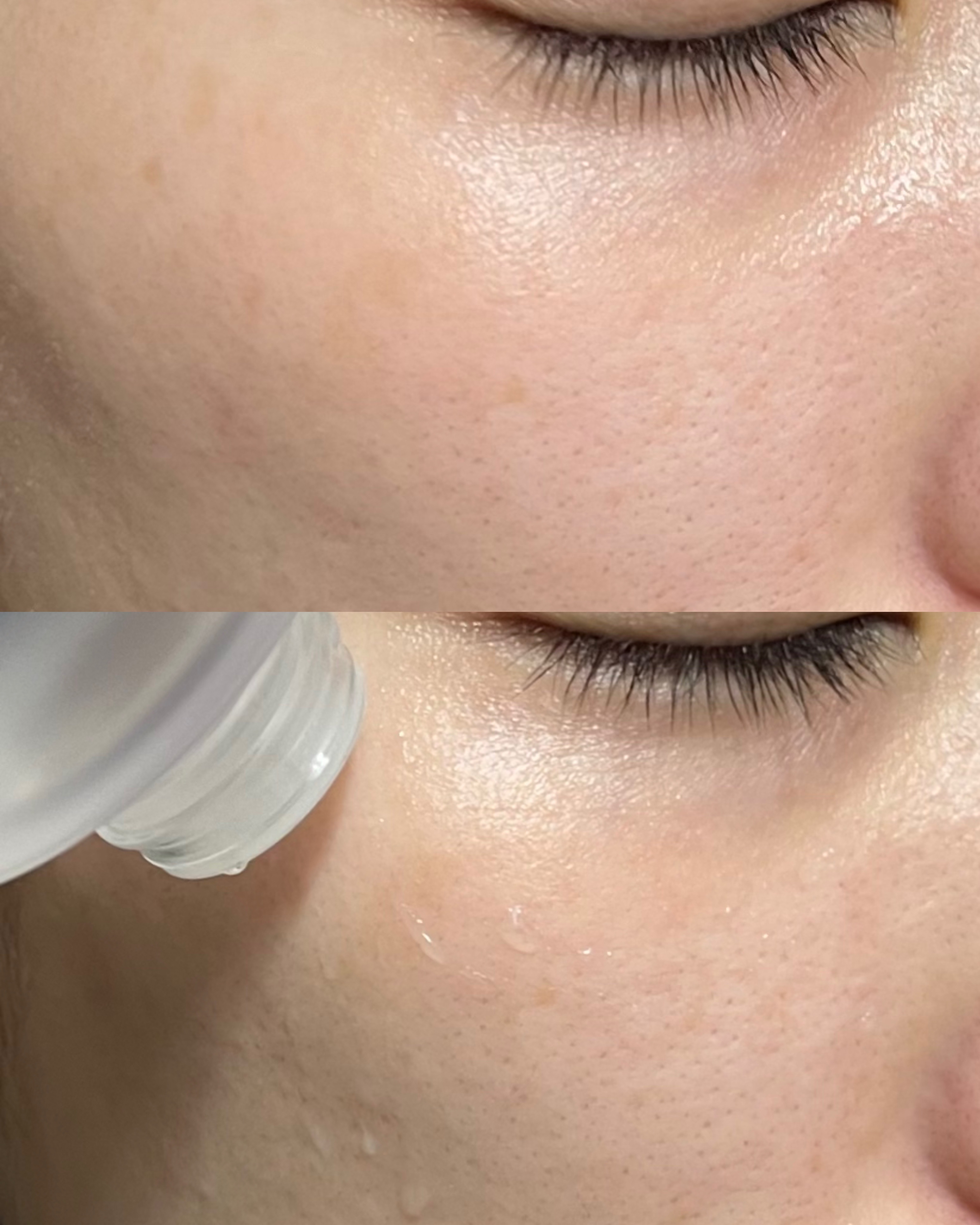 ダーマジェンシー ゼロカ86 トナー/DERMAGENCY/化粧水を使ったクチコミ（3枚目）