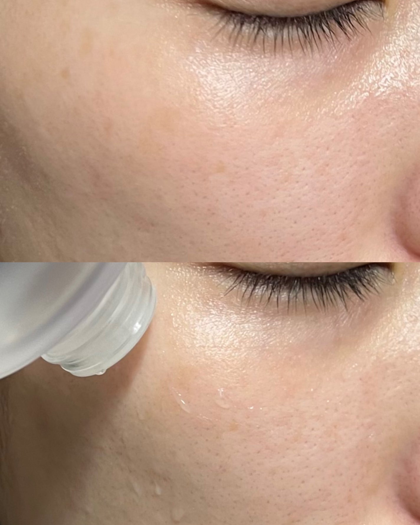 ダーマジェンシー ゼロカ86 トナー/DERMAGENCY/化粧水を使ったクチコミ(3枚目)