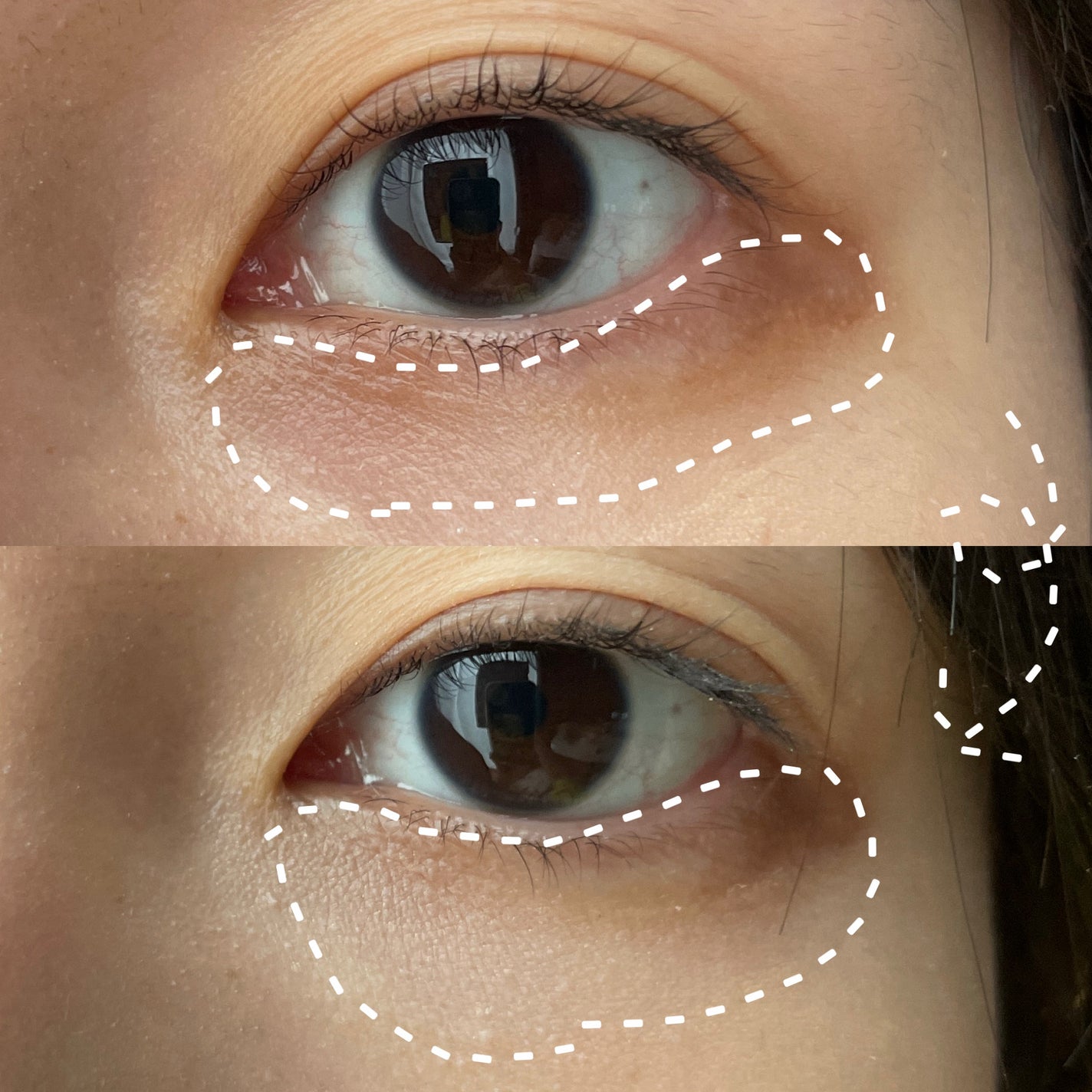 スポットメンテパウダー/muice/プレストパウダーを使ったクチコミ(3枚目)