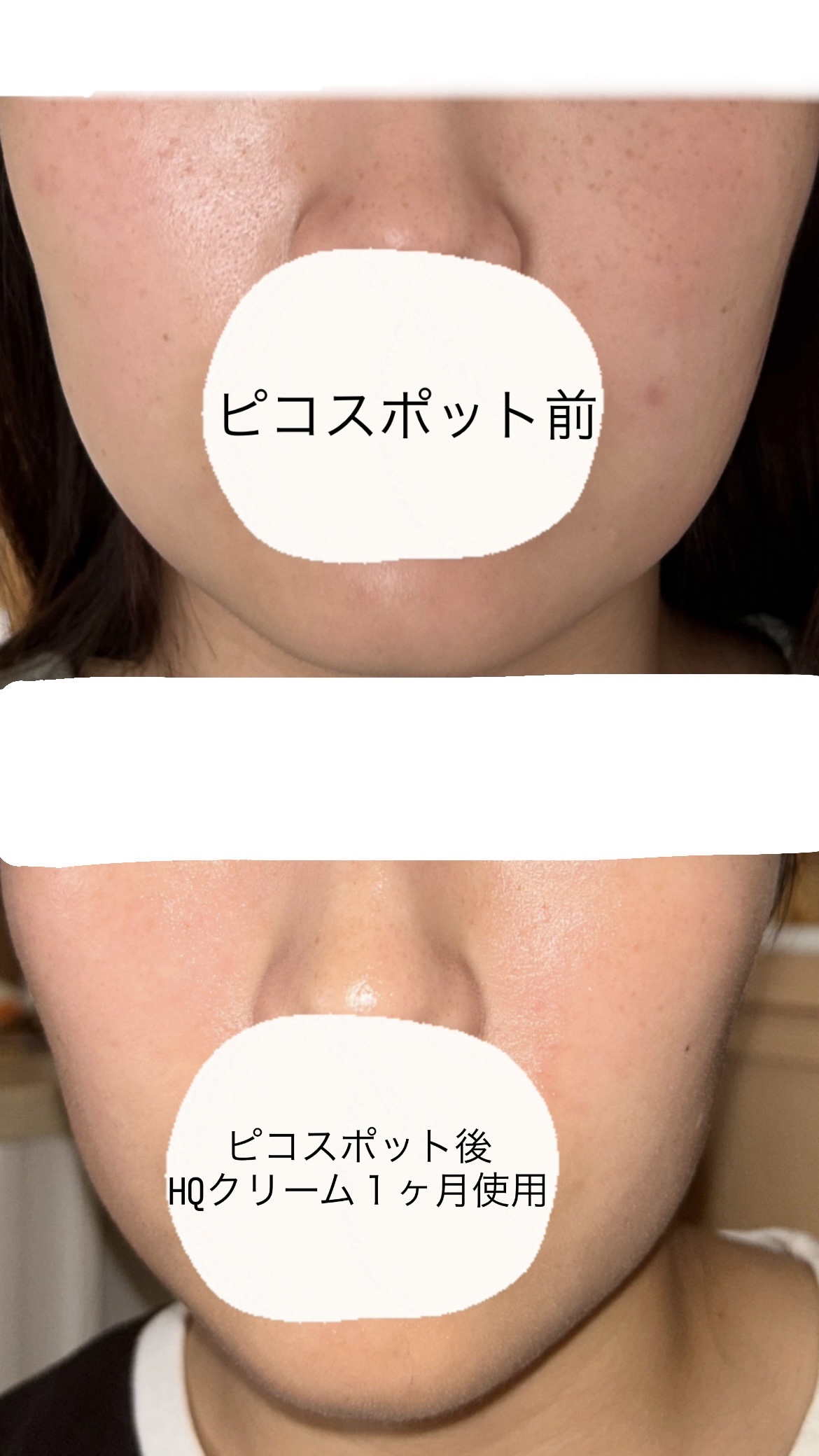 UV  アスリズム　スキンプロテクトエッセンス/ビオレ/日焼け止めローションを使ったクチコミ（2枚目）