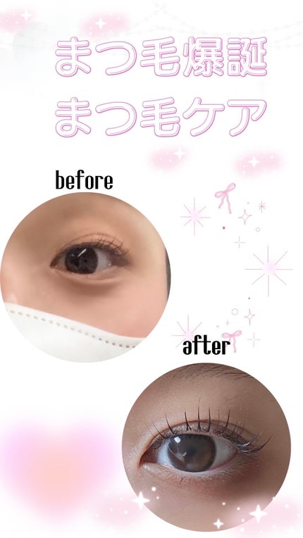フェニックス アイラッシュサポートジェル/オデットアイラッシュコスメティクス/まつげ美容液を使ったクチコミ(1枚目)