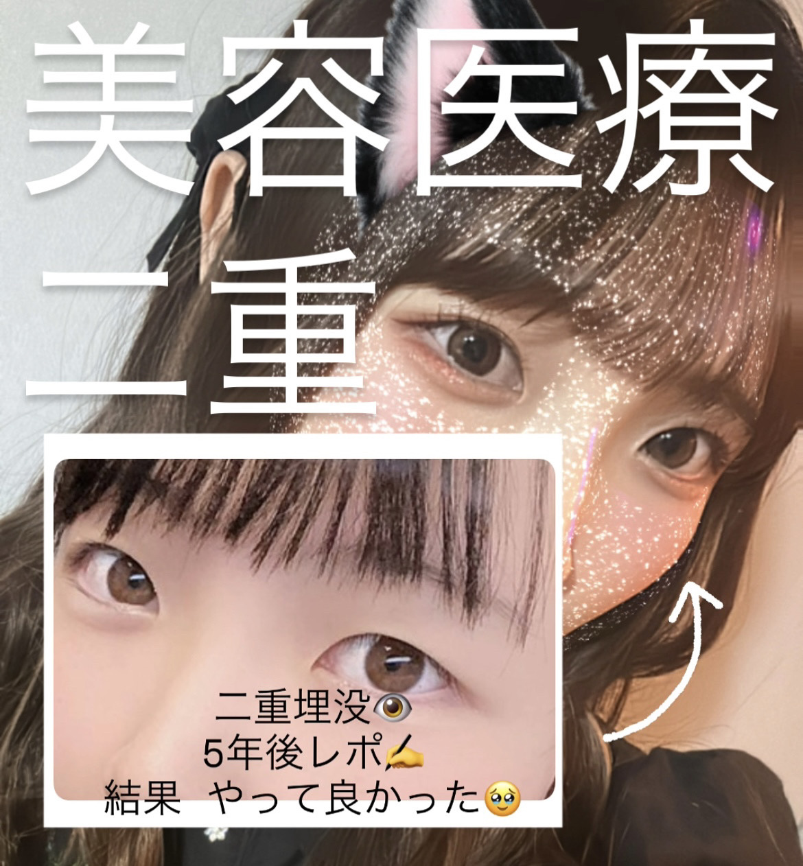 ダブルアイリキッド/Automatic Beauty/二重まぶた用アイテムを使ったクチコミ（1枚目）