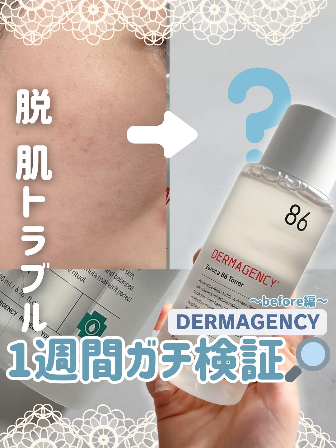 ダーマジェンシー ゼロカ86 トナー/DERMAGENCY/化粧水を使ったクチコミ（1枚目）