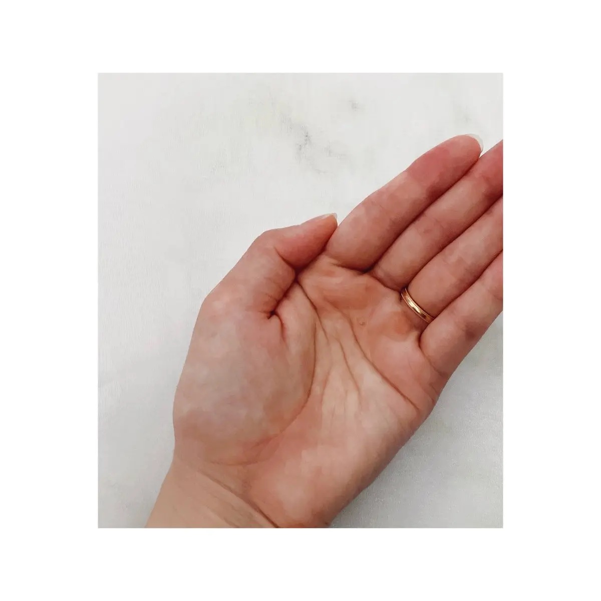 ダーマジェンシー ゼロカ86 トナー/DERMAGENCY/化粧水を使ったクチコミ（3枚目）