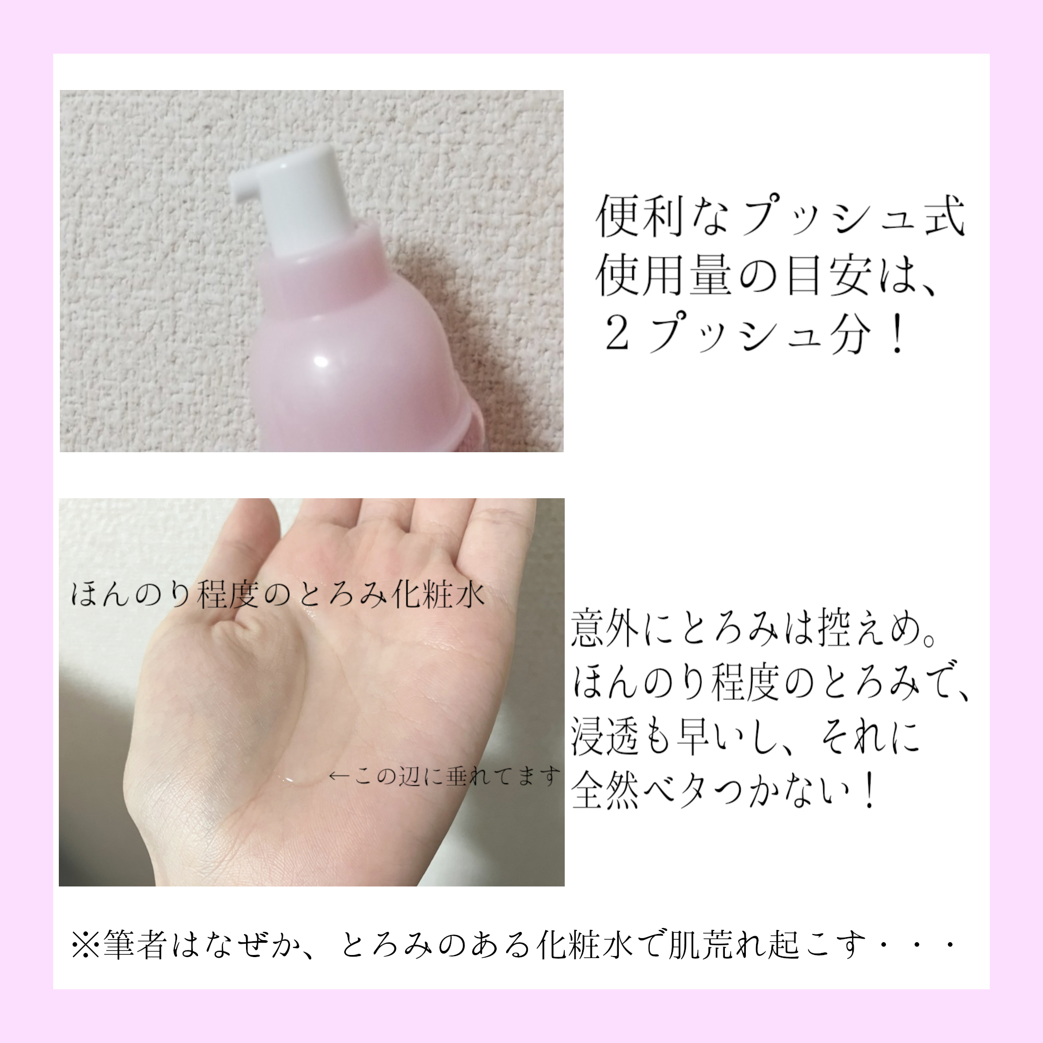 モイストケア ローション MB/d プログラム/化粧水を使ったクチコミ（3枚目）