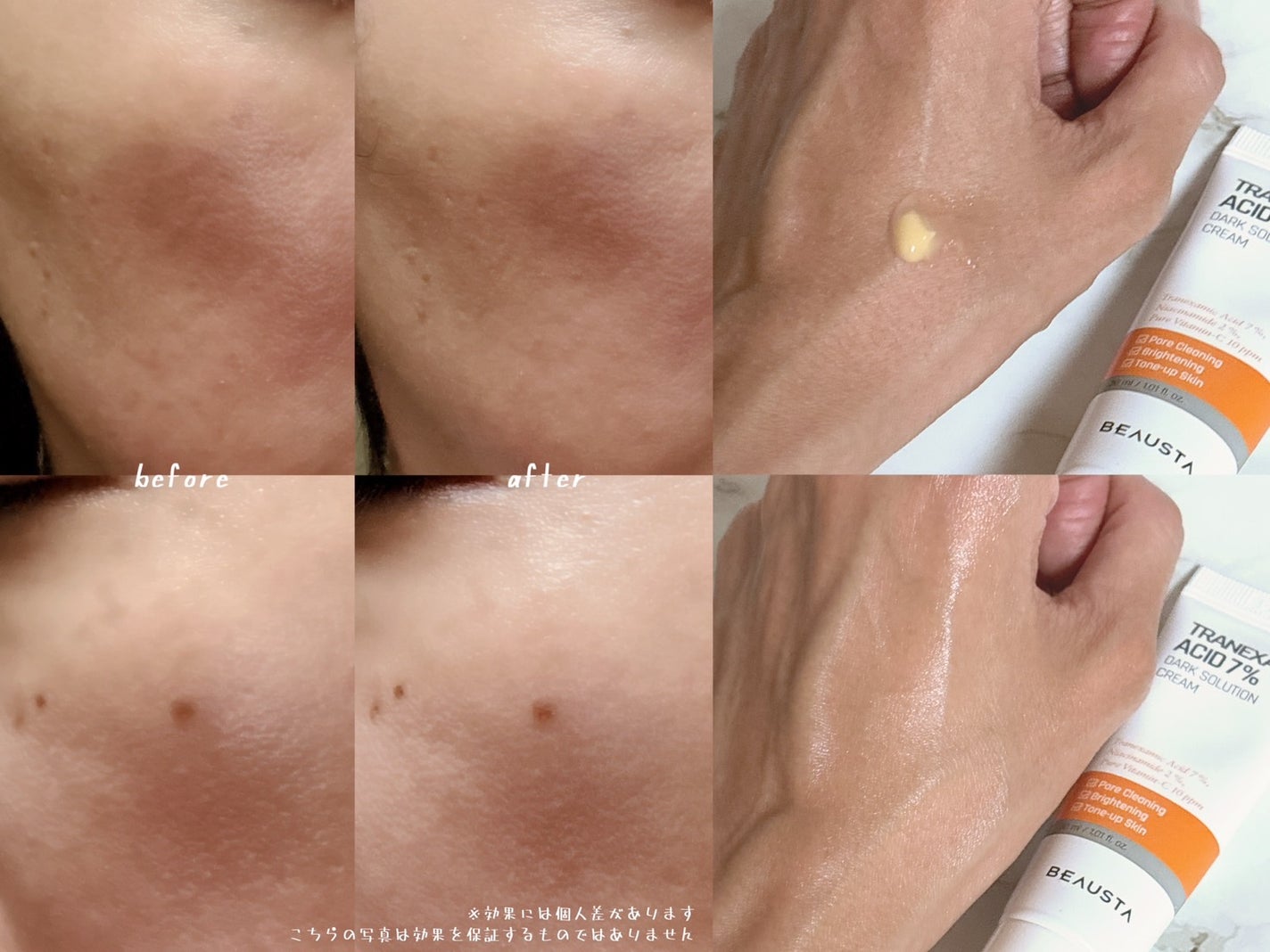 トラネキサム酸7%ダークソリューションクリーム/BEAUSTA/フェイスクリームを使ったクチコミ(2枚目)