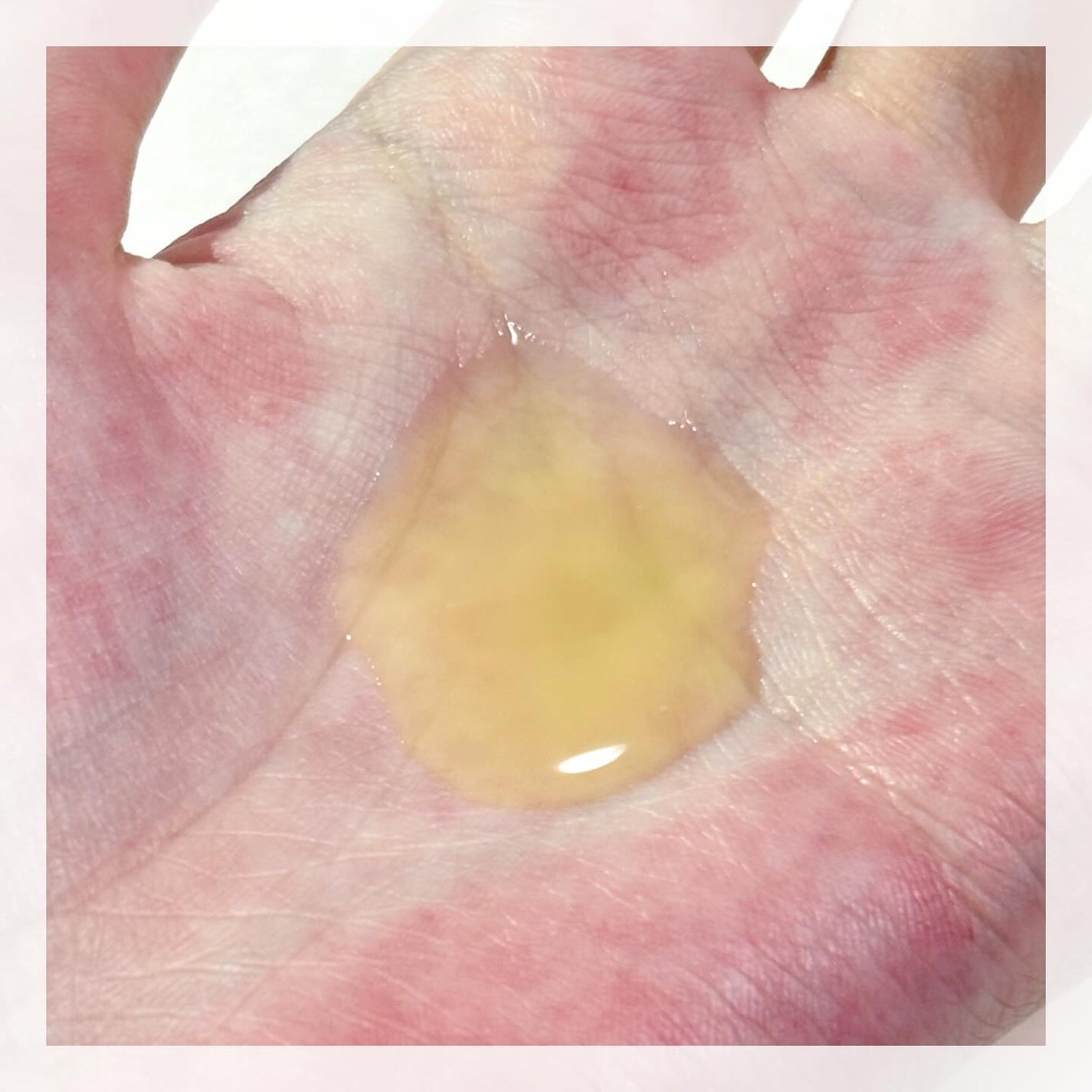 薬用VC ブライトエッセンス/chant a charm /美容液を使ったクチコミ(3枚目)