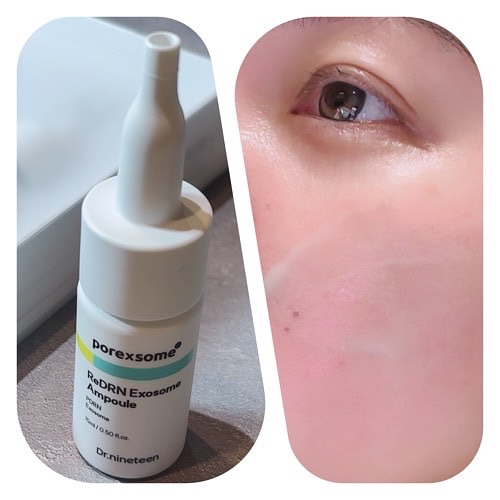 ReDRNエクソソームアンプル/Dr.nineteen/美容液を使ったクチコミ（3枚目）