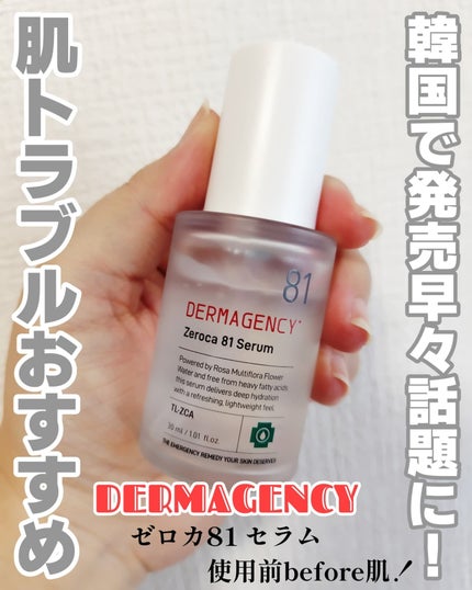 ダーマジェンシー ゼロカ81 セラム/DERMAGENCY/美容液を使ったクチコミ(1枚目)