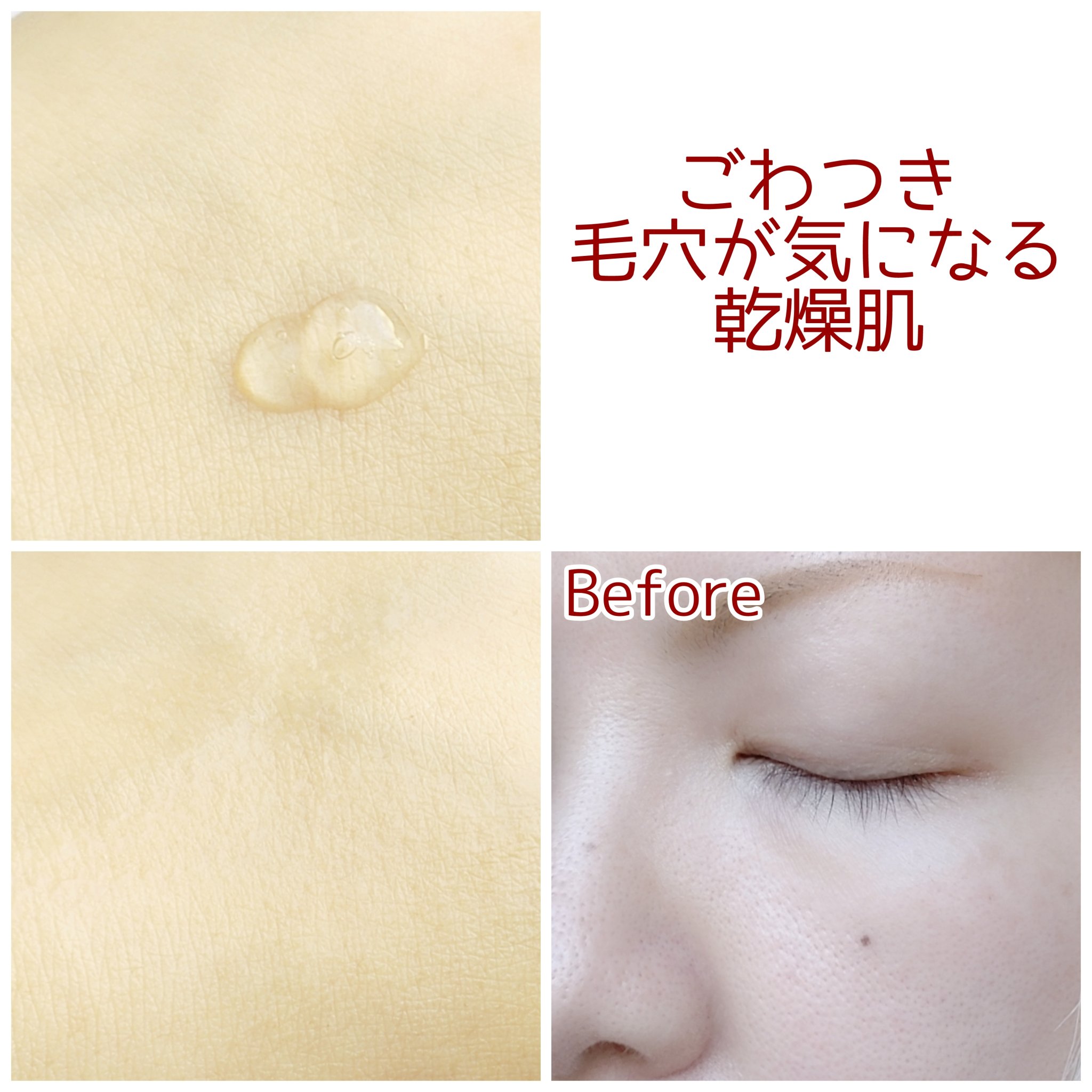 ダーマジェンシー ゼロカ81 セラム/DERMAGENCY/美容液を使ったクチコミ（3枚目）