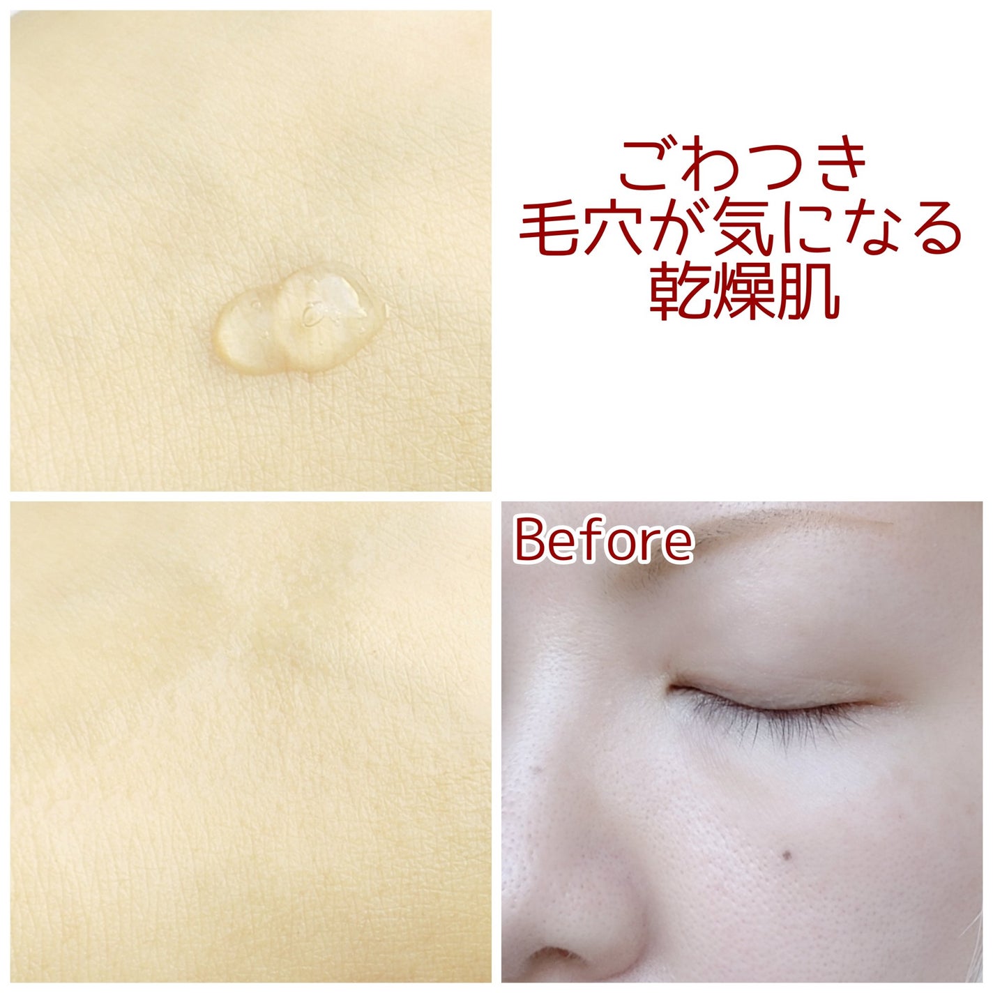 ダーマジェンシー ゼロカ81 セラム/DERMAGENCY/美容液を使ったクチコミ(3枚目)