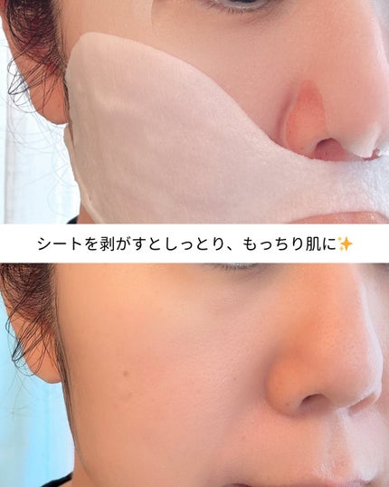 デュイセル プライベートケアマスク/DEWYCEL/シートマスク・パックを使ったクチコミ(4枚目)