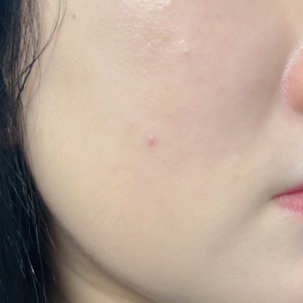 ダーマジェンシー ゼロカ86 トナー/DERMAGENCY/化粧水を使ったクチコミ(3枚目)