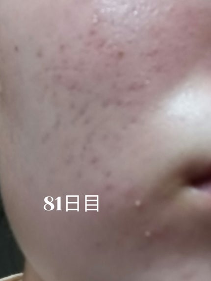 ã䜿ã£ãã¯ãã³ãïŒ1æç®ïŒ