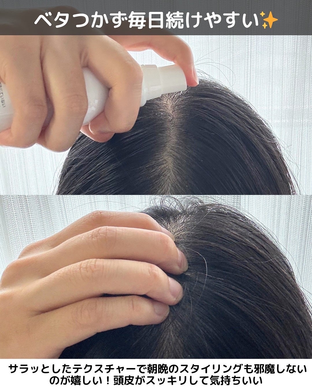 薬用育毛ローション RANMU/RANMU/頭皮ローションを使ったクチコミ(4枚目)