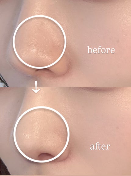 ロングラスティングチップコンシーラー/LUNA/リキッドコンシーラーを使ったクチコミ(4枚目)