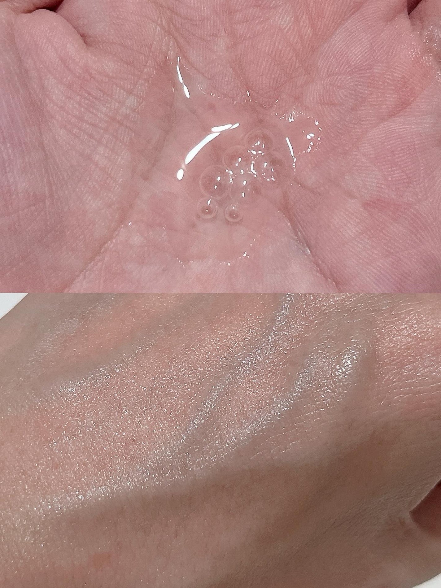 ノスカナイン トラブル セラム/FATION/美容液を使ったクチコミ(3枚目)