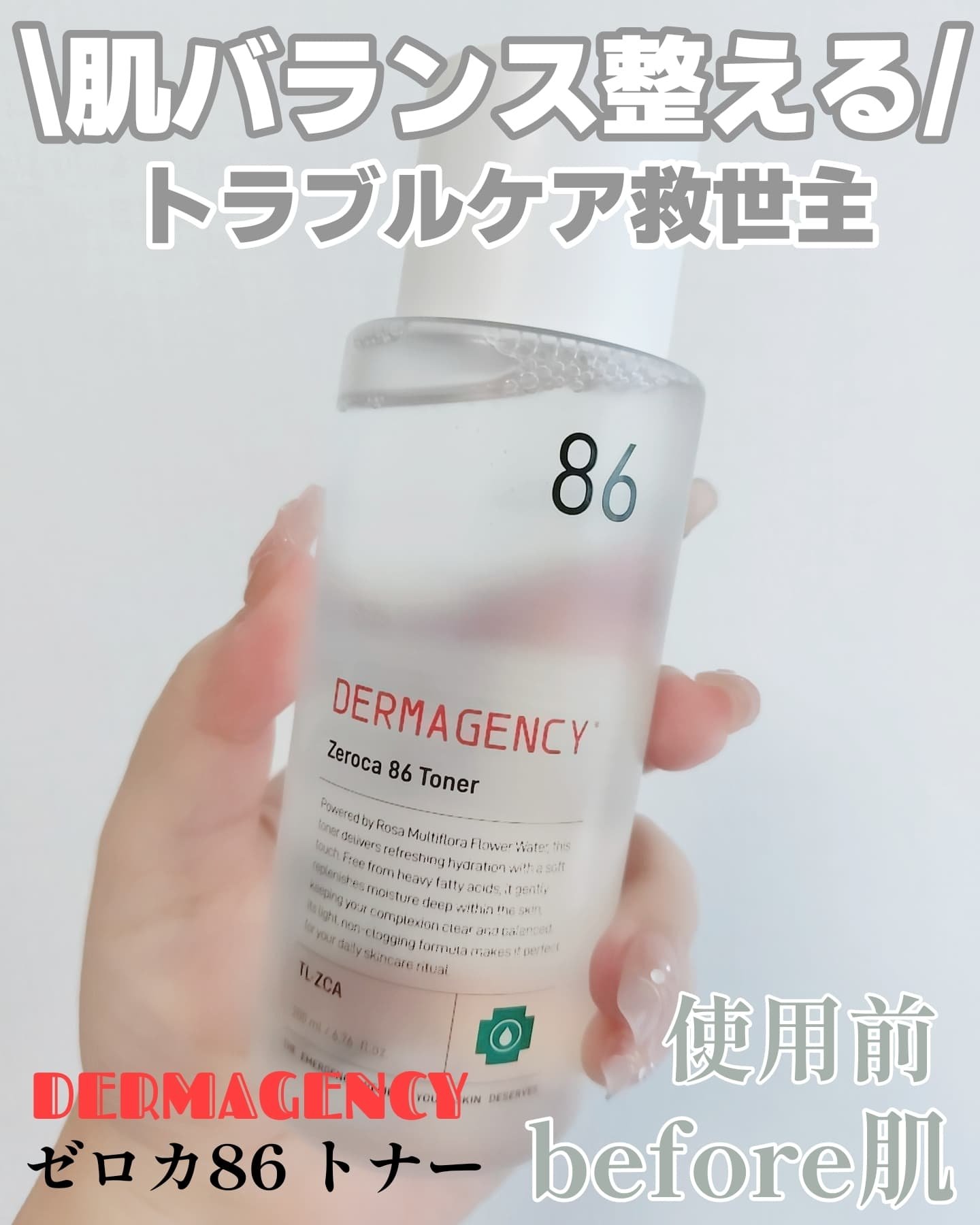 ダーマジェンシー ゼロカ86 トナー/DERMAGENCY/化粧水を使ったクチコミ（1枚目）