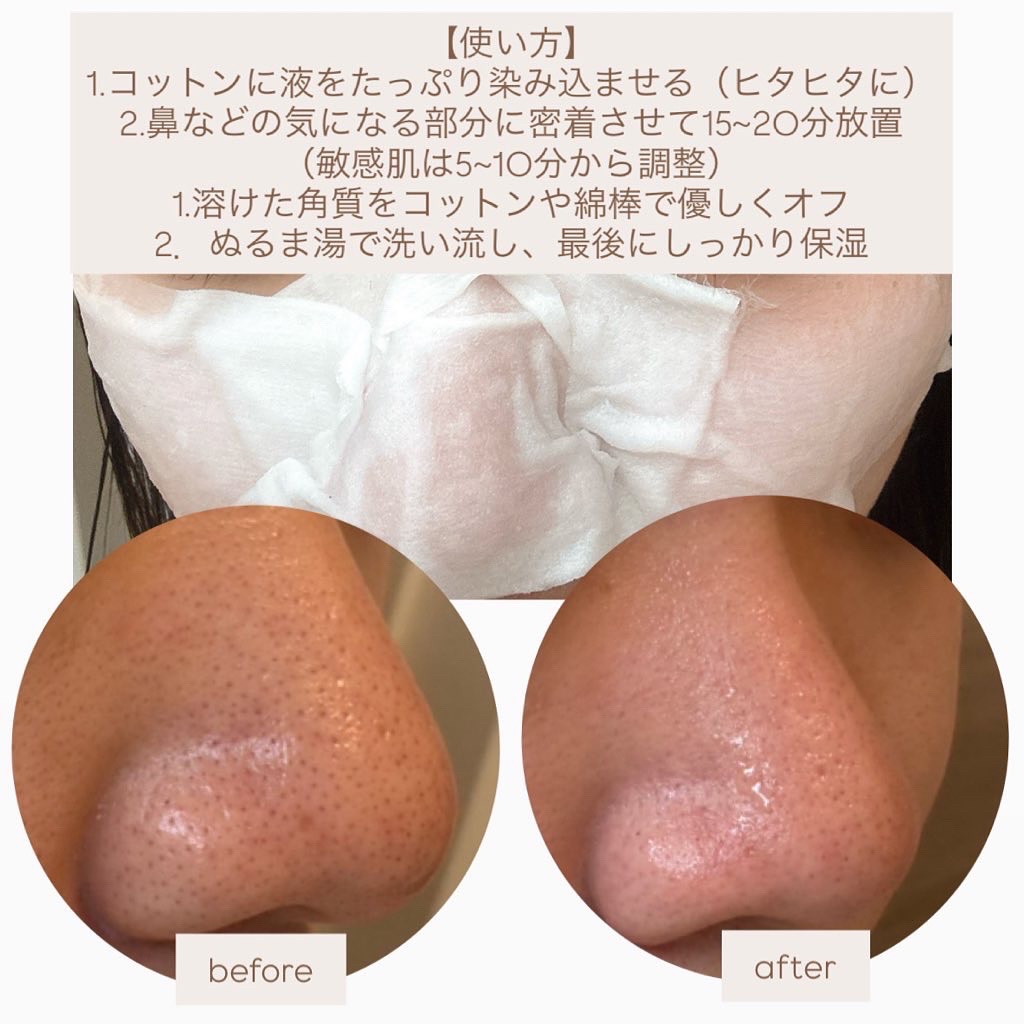 ノーモアブラックヘッド(ノーズピーリング)/One-day's you/スクラブ・ゴマージュを使ったクチコミ（2枚目）