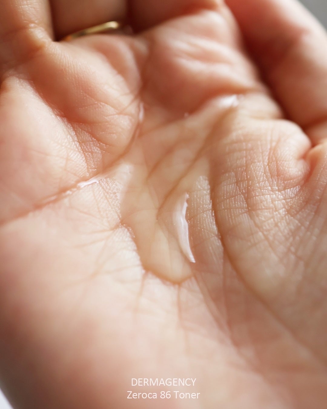 ダーマジェンシー ゼロカ86 トナー/DERMAGENCY/化粧水を使ったクチコミ(3枚目)
