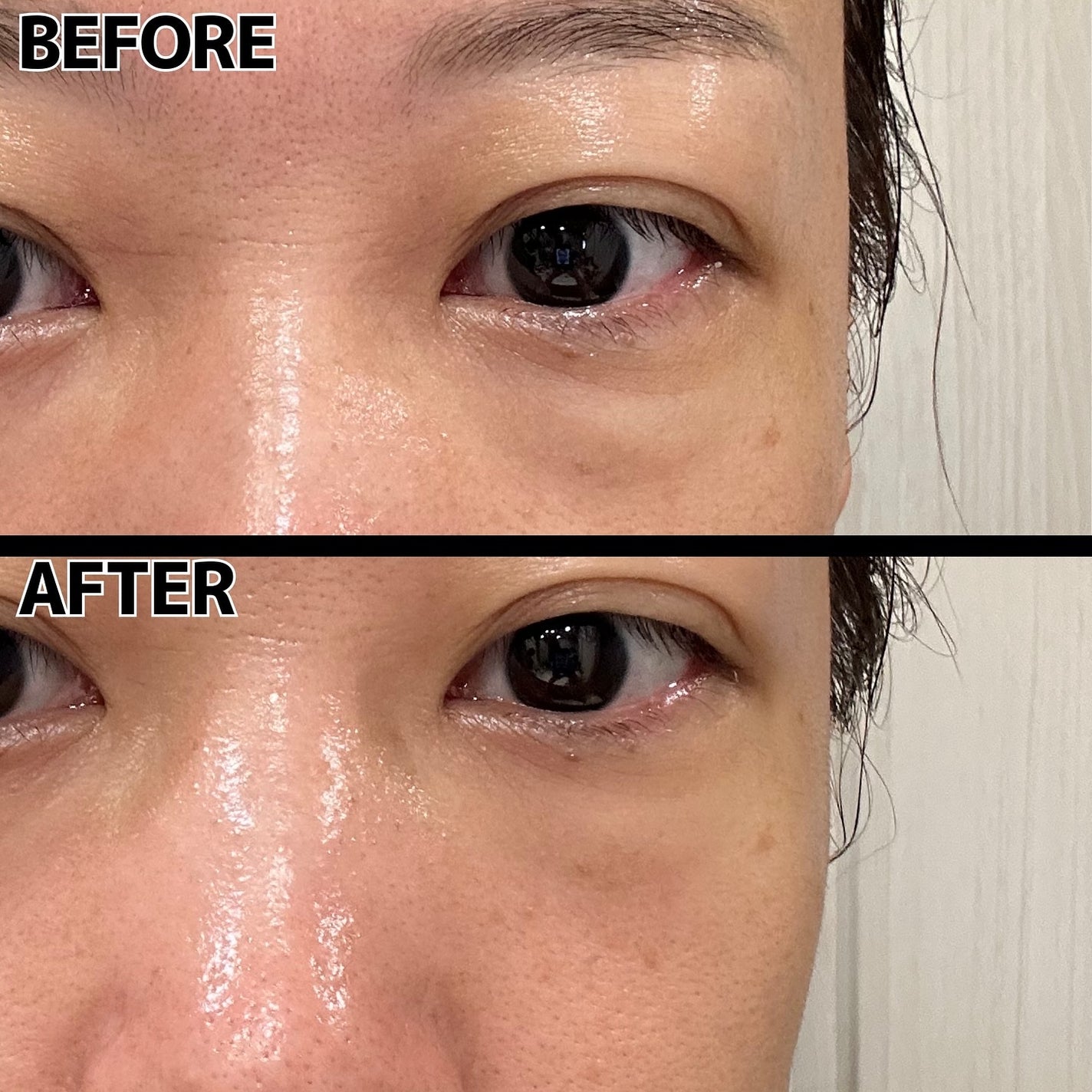 目元美顔器/ANLAN/美顔器・マッサージを使ったクチコミ(4枚目)