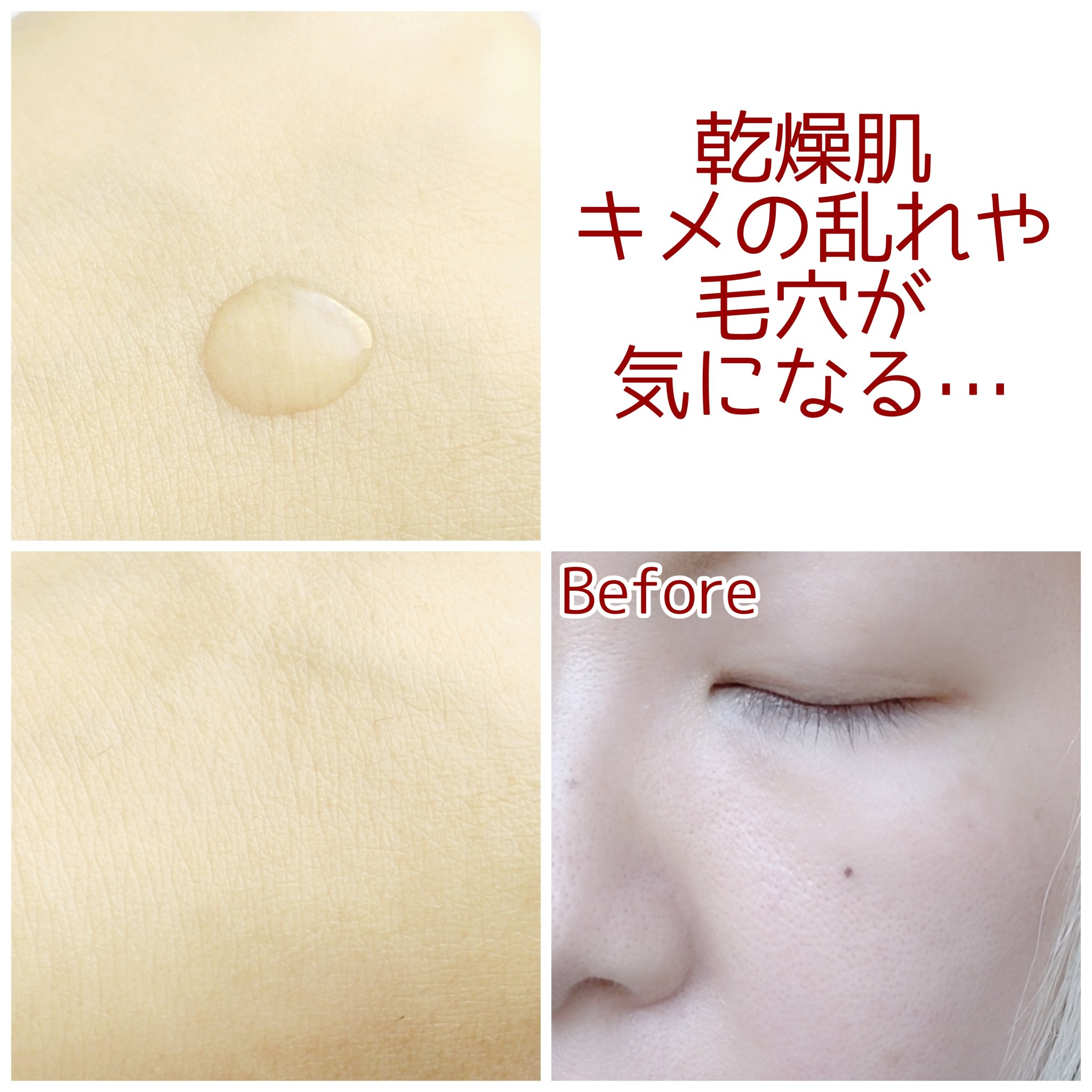 ダーマジェンシー ゼロカ86 トナー/DERMAGENCY/化粧水を使ったクチコミ（3枚目）