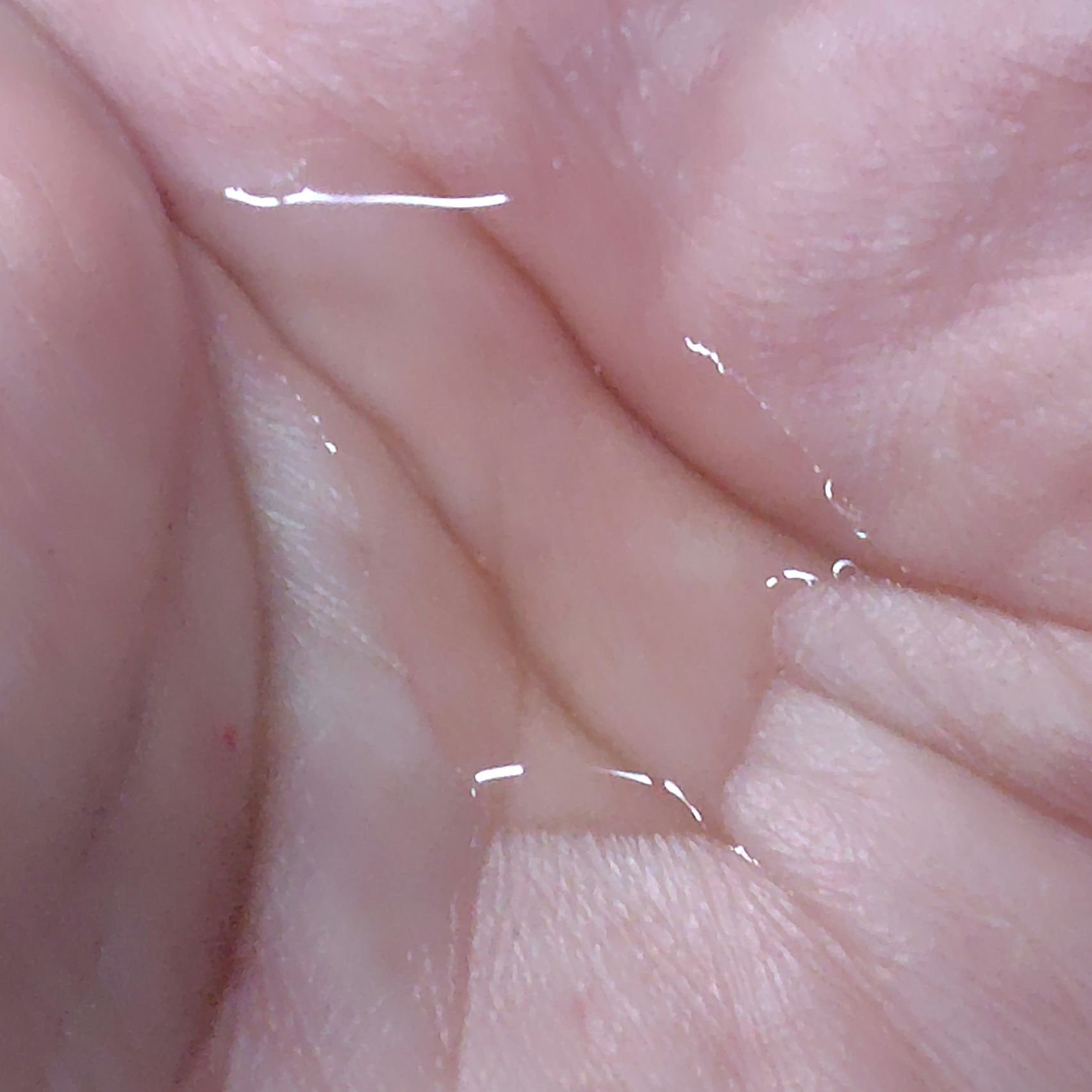 スープラ トリートメント エッセンス ローション N/CLARINS/化粧水を使ったクチコミ（3枚目）