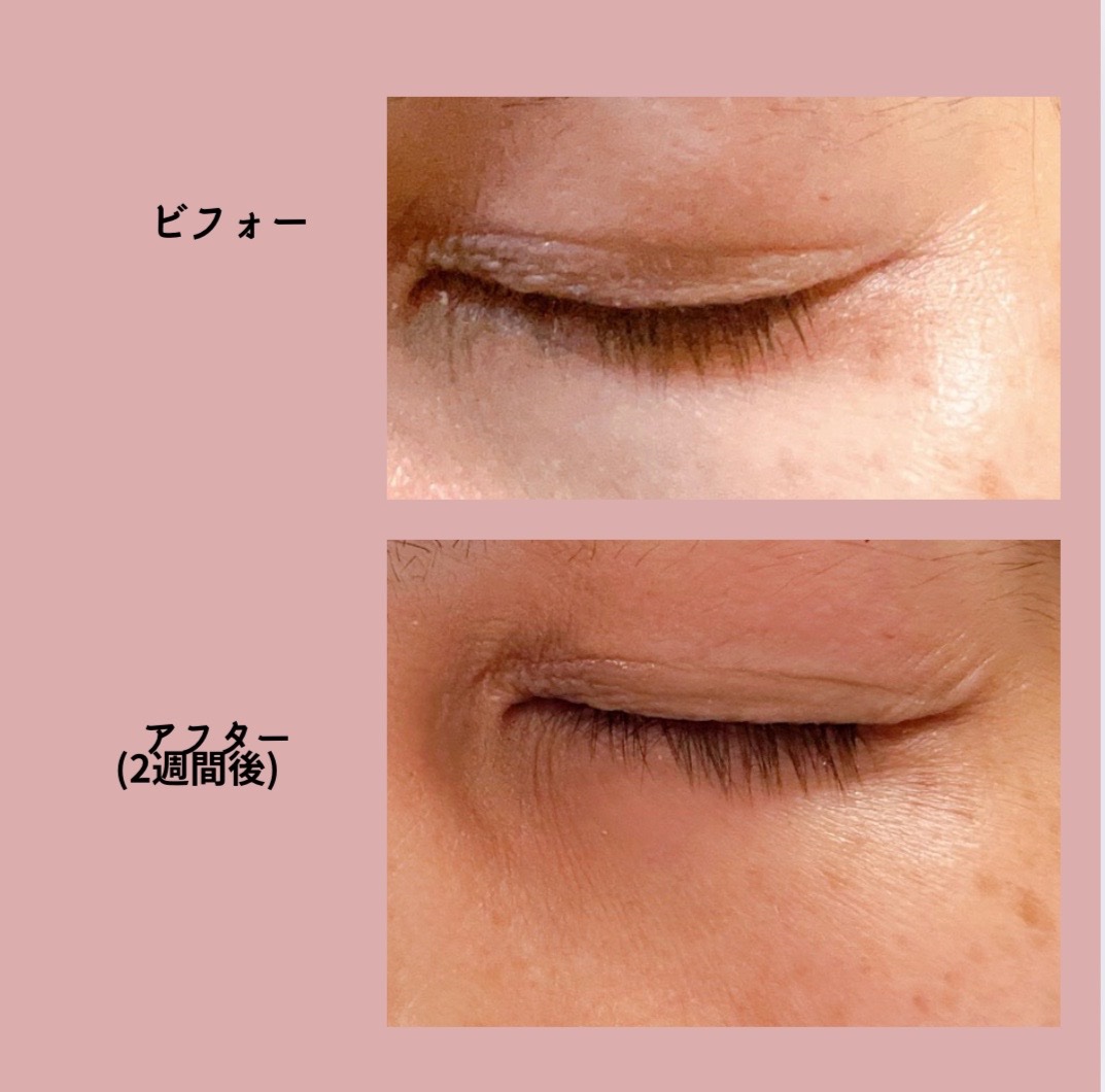 Lock On アイラッシュセラム/NICORIO（ニコリオ）/まつげ美容液を使ったクチコミ（3枚目）