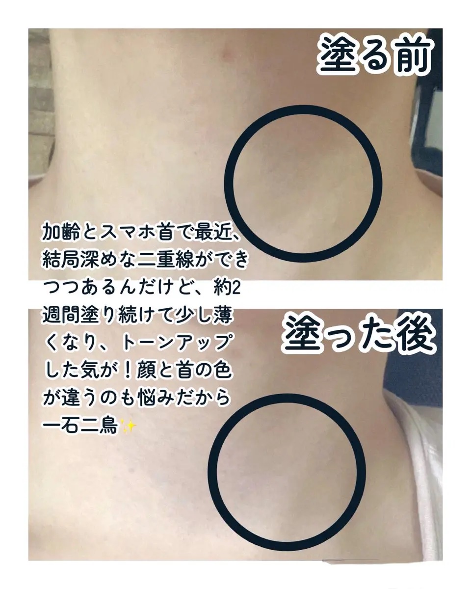 BnD ネックアイロン トーンアップ クリーム/BnD/ネック・デコルテケアを使ったクチコミ（3枚目）