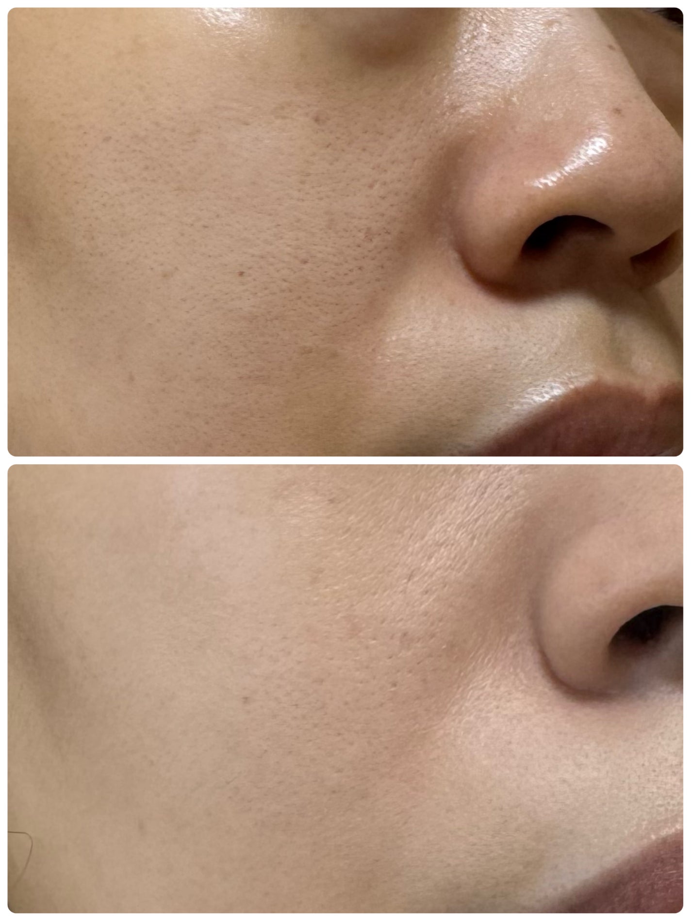 デューイーメッシュファンデーション/ASUNE /クッションファンデーションを使ったクチコミ(4枚目)