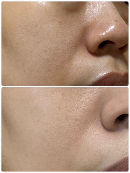 デューイーメッシュファンデーション/ASUNE /クッションファンデーションを使ったクチコミ(4枚目)