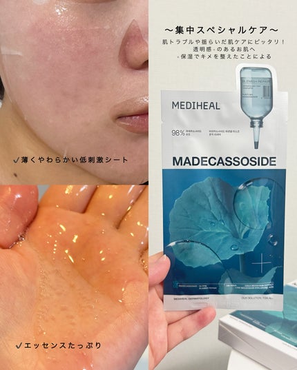 マデカッソシド エッセンシャルマスク/MEDIHEAL/シートマスク・パックを使ったクチコミ(4枚目)