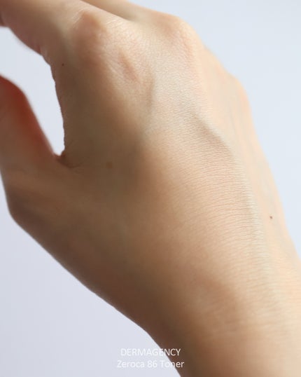 ダーマジェンシー ゼロカ86 トナー/DERMAGENCY/化粧水を使ったクチコミ(4枚目)