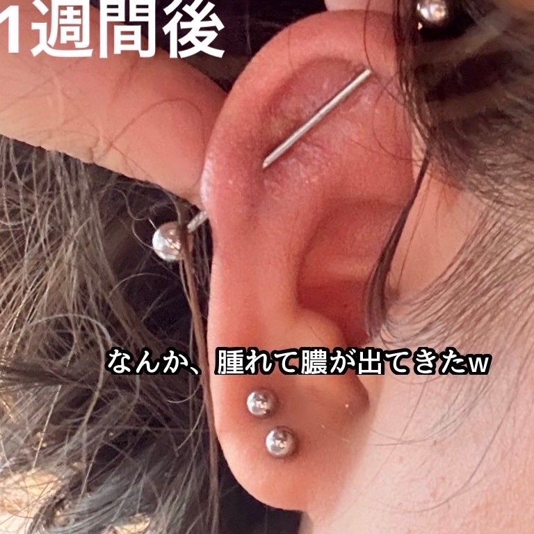 ドルマイシン軟膏(医薬品)/ゼリア新薬工業/その他を使ったクチコミ(4枚目)