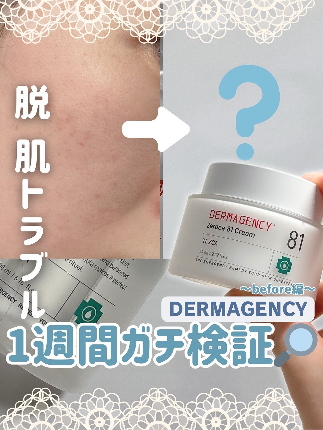 ダーマジェンシー ゼロカ81 クリーム/DERMAGENCY/フェイスクリームを使ったクチコミ(1枚目)