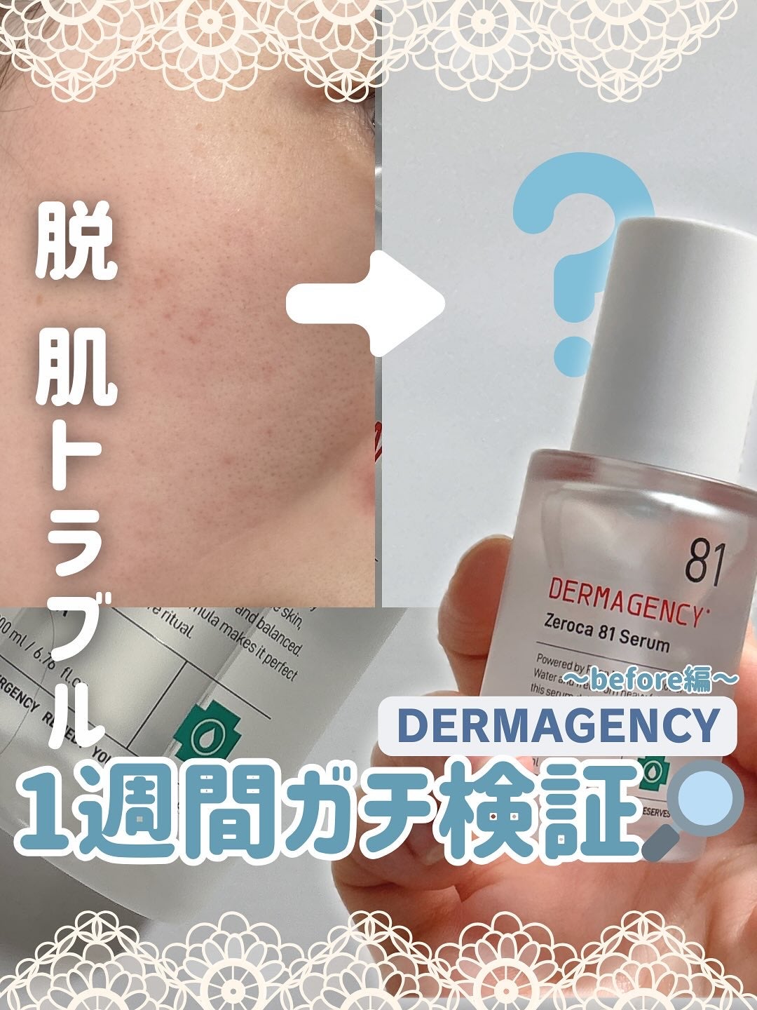 ダーマジェンシー ゼロカ81 セラム/DERMAGENCY/美容液を使ったクチコミ(1枚目)
