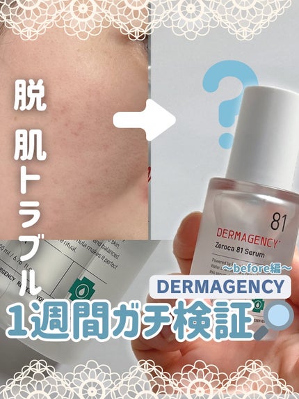 ダーマジェンシー ゼロカ81 セラム/DERMAGENCY/美容液を使ったクチコミ(1枚目)