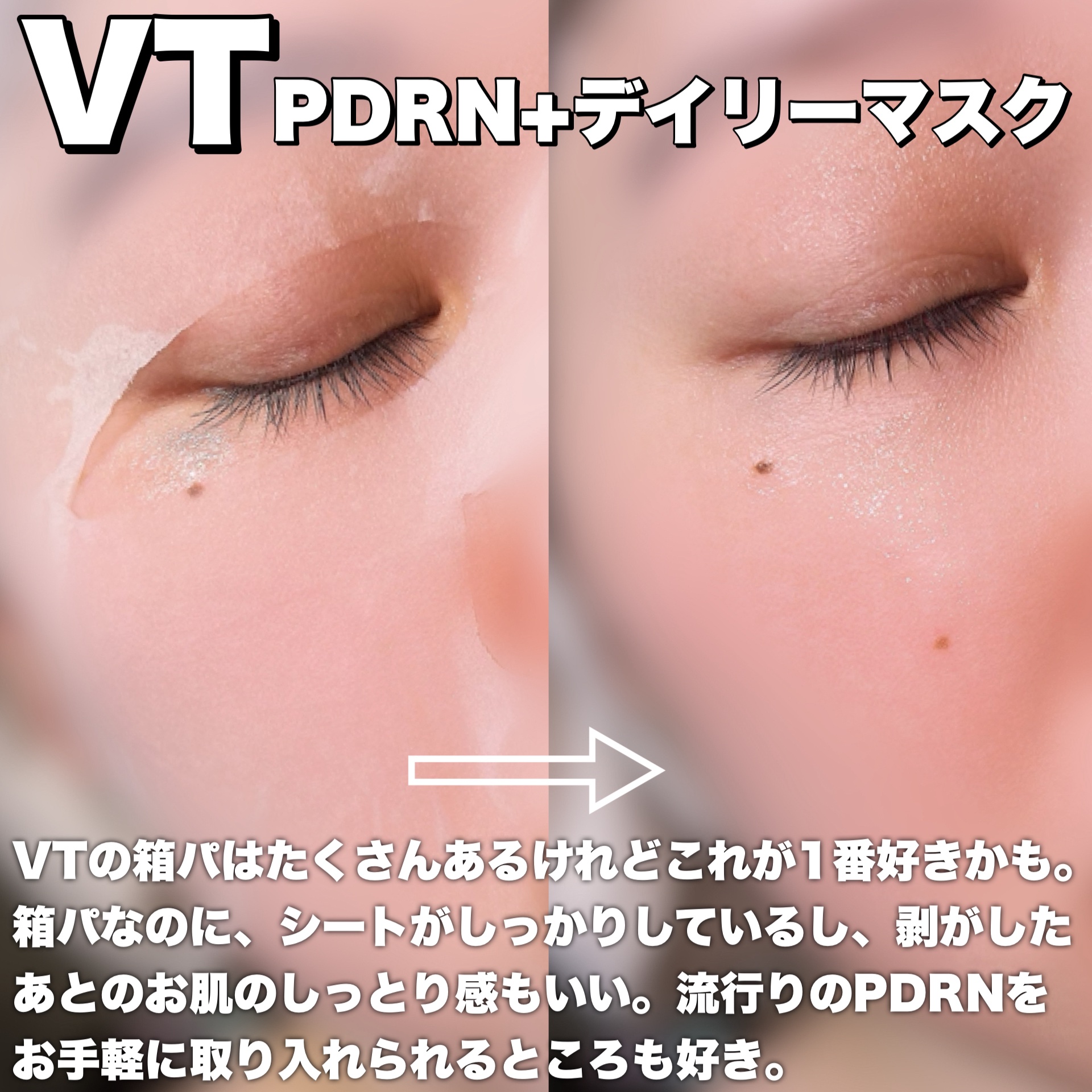 PDRN+ デイリーマスク/VT/シートマスク・パックを使ったクチコミ（3枚目）