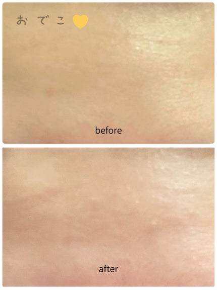 レッドブレミッシュ クリアモイスチャークリーム/Dr.G/フェイスクリームを使ったクチコミ(7枚目)