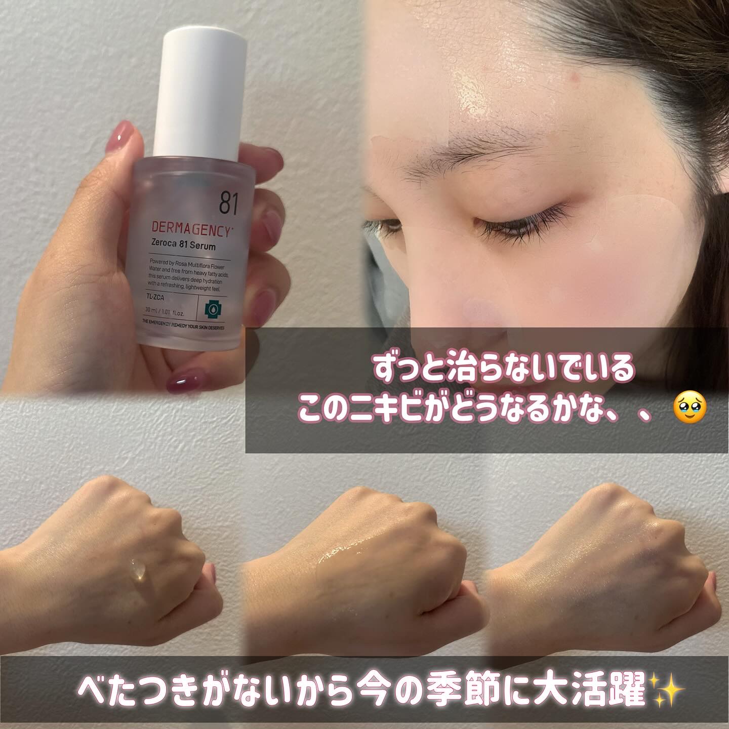 ダーマジェンシー ゼロカ81 セラム/DERMAGENCY/美容液を使ったクチコミ（3枚目）