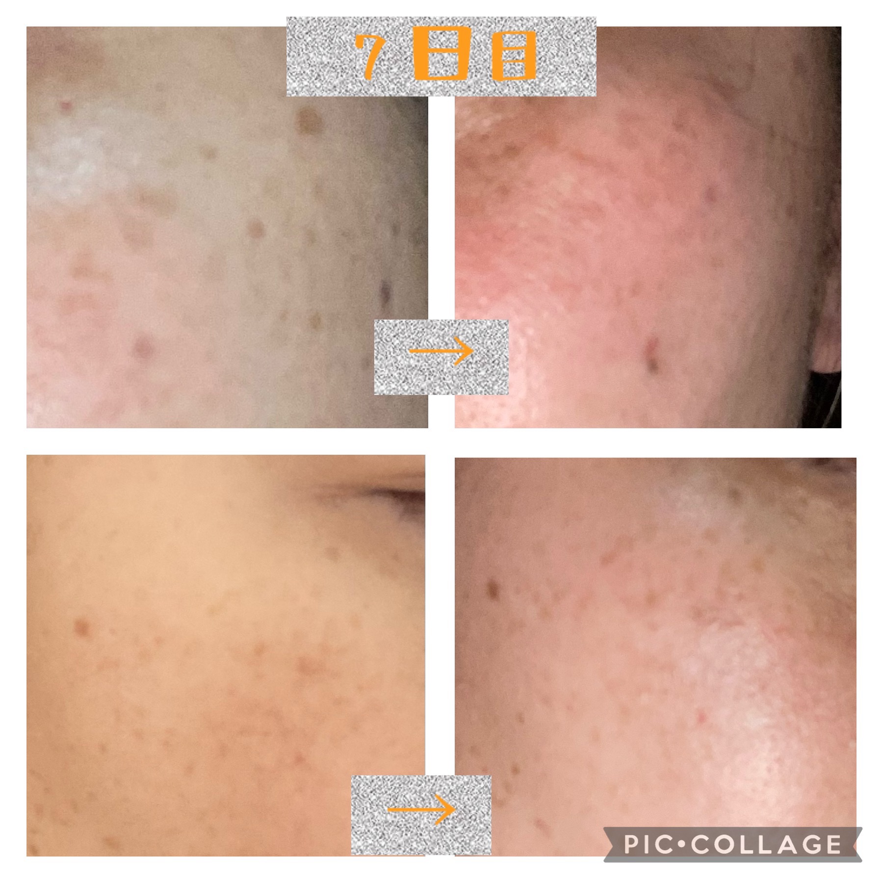 ハイドロクリームPHQ-8/KISO/美容液を使ったクチコミ（1枚目）