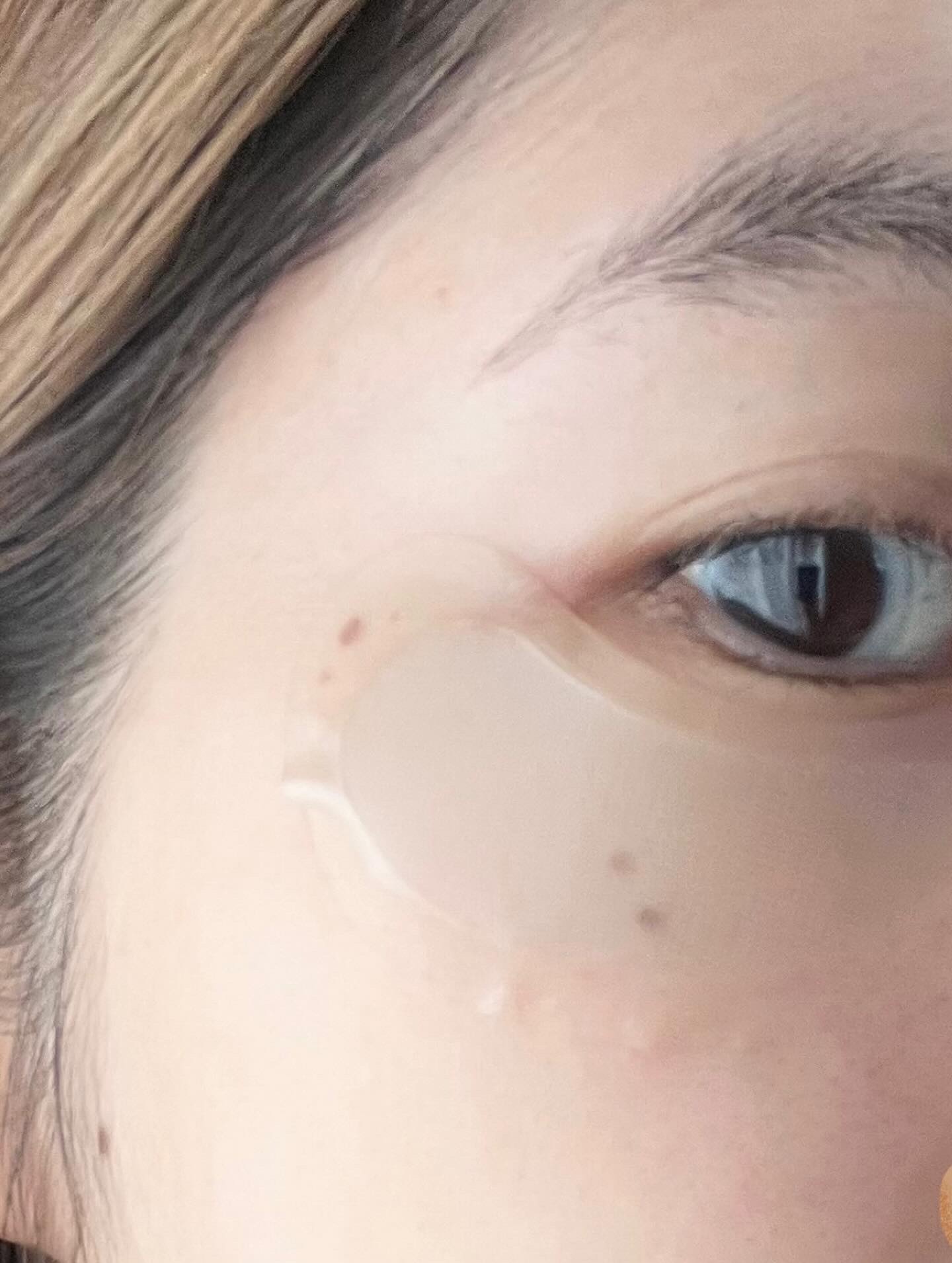 アイバックリフト1100シャットリードルパッチ/CHARDE/シートマスク・パックを使ったクチコミ（3枚目）