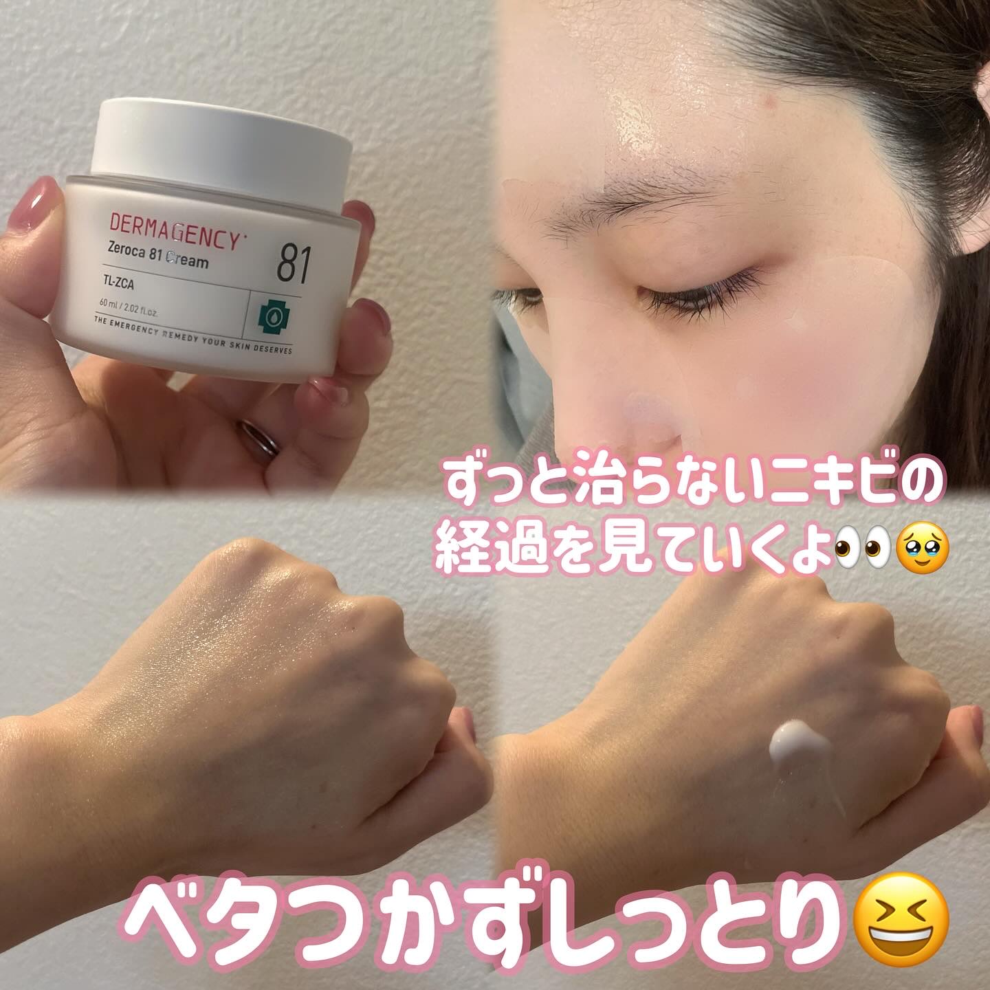 ダーマジェンシー ゼロカ81 クリーム/DERMAGENCY/フェイスクリームを使ったクチコミ（3枚目）