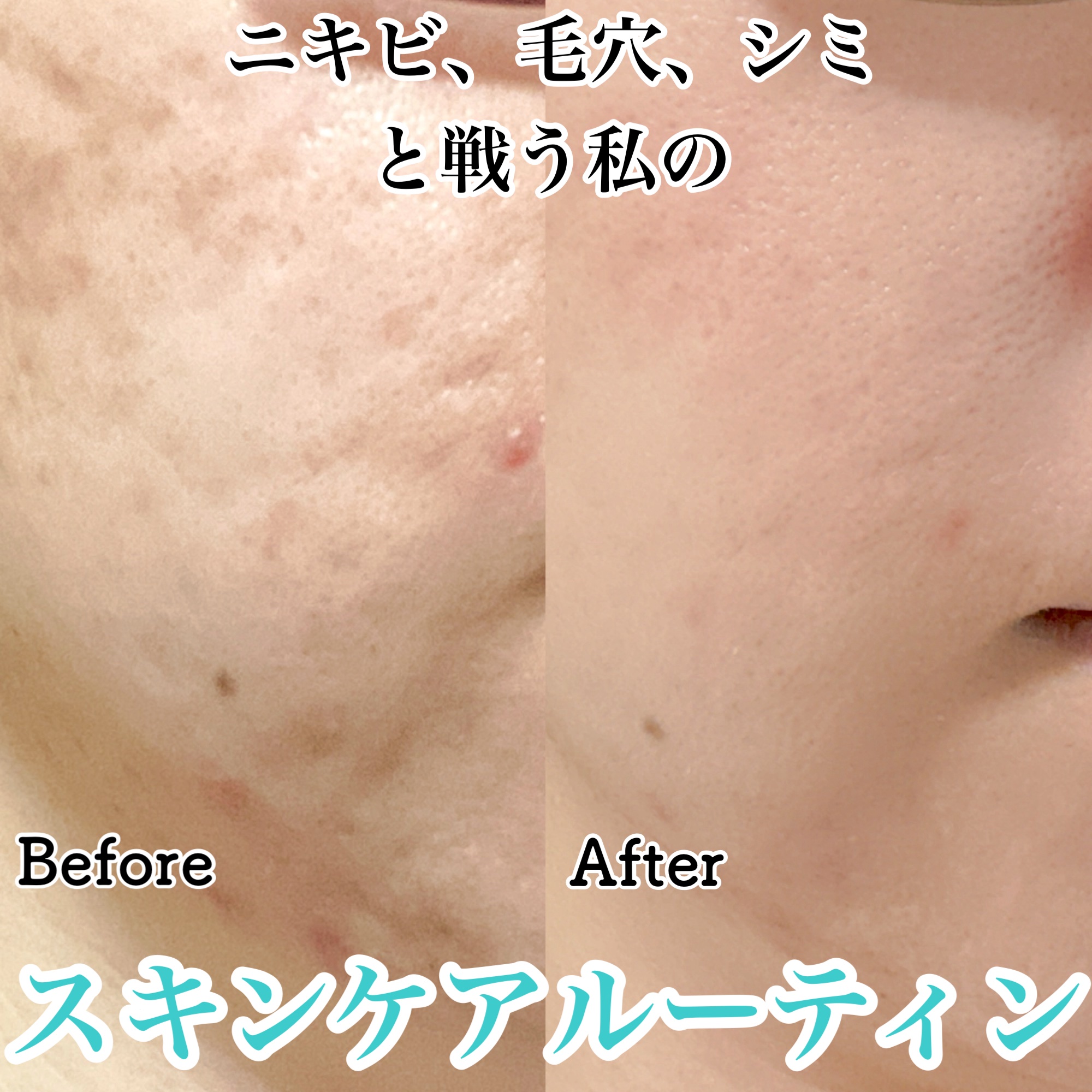 潤浸保湿 化粧水 III とてもしっとり/キュレル/化粧水を使ったクチコミ（1枚目）